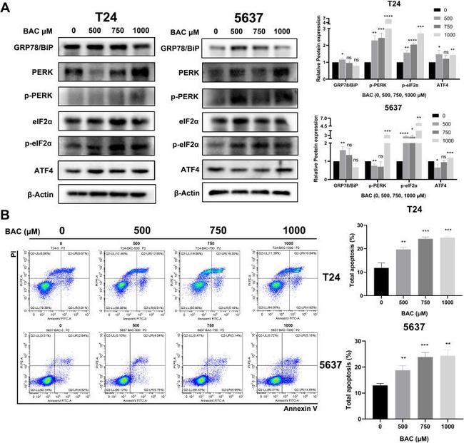 Phospho-PERK (Thr982) Antibody in Western Blot (WB)