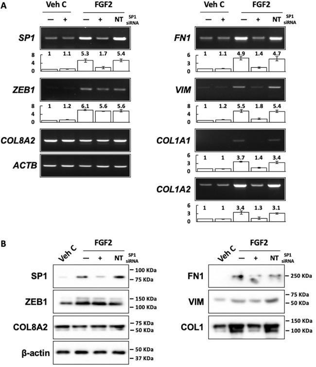 ZEB1 Antibody in Western Blot (WB)