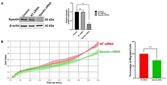 Spastin Antibody in Western Blot (WB)