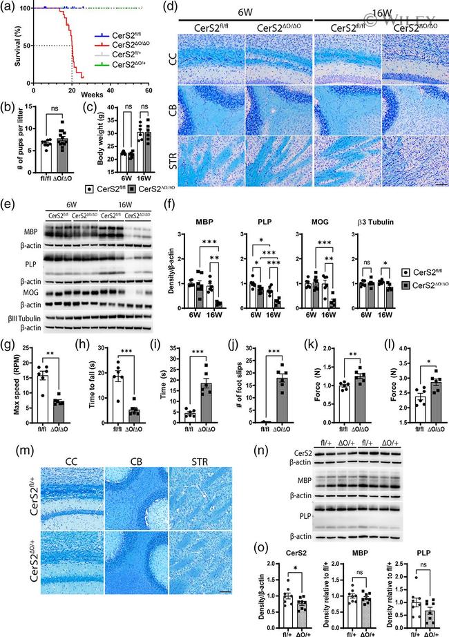 Lass2 Antibody in Western Blot (WB)