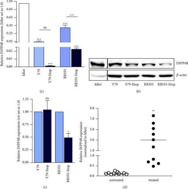 INPP4B Antibody in Western Blot (WB)