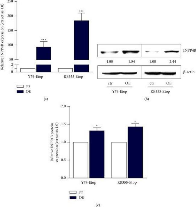 INPP4B Antibody in Western Blot (WB)