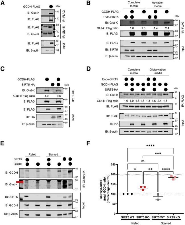 GCDH Antibody in Western Blot (WB)