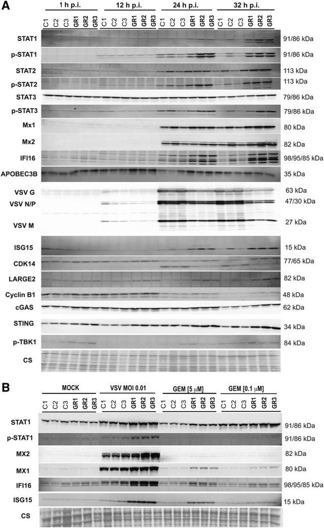 GYLTL1B Antibody in Western Blot (WB)