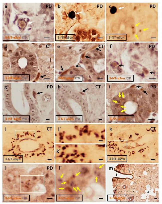 IYD Antibody in Immunohistochemistry (IHC)