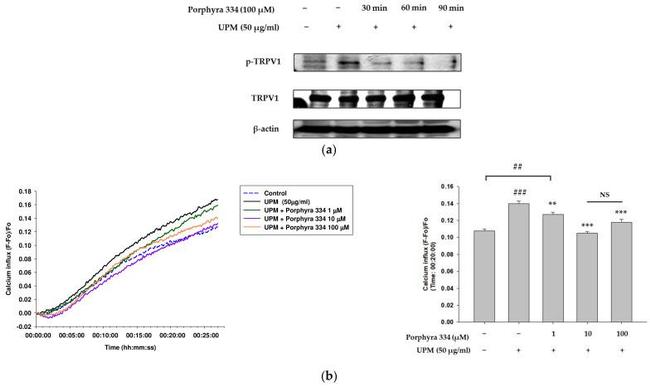 Phospho-TRPV1 (Ser502) Antibody in Western Blot (WB)