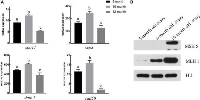 MSH5 Antibody in Western Blot (WB)