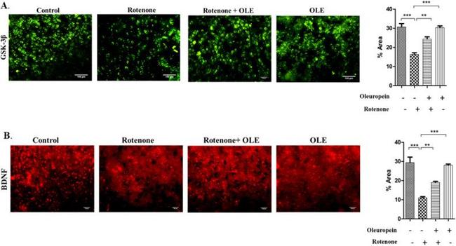 BDNF Antibody in Immunohistochemistry (IHC)