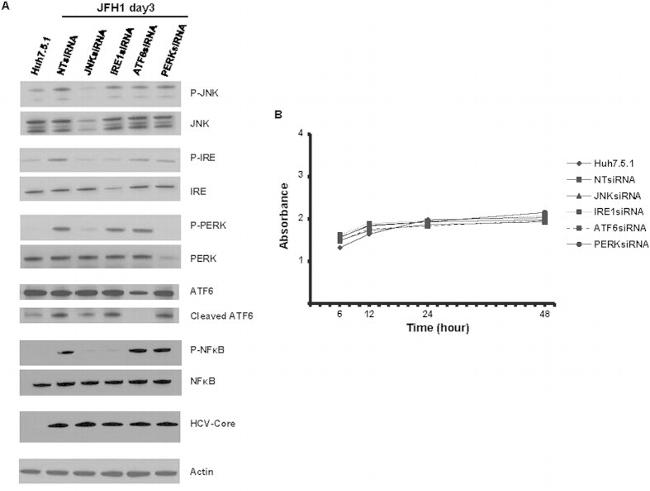 Phospho-PERK (Thr980) Antibody in Western Blot (WB)