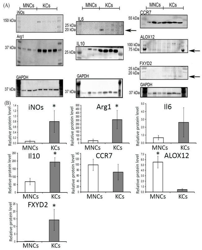 ALOX12 Antibody in Western Blot (WB)