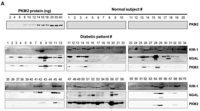 KIM-1 Antibody in Western Blot (WB)