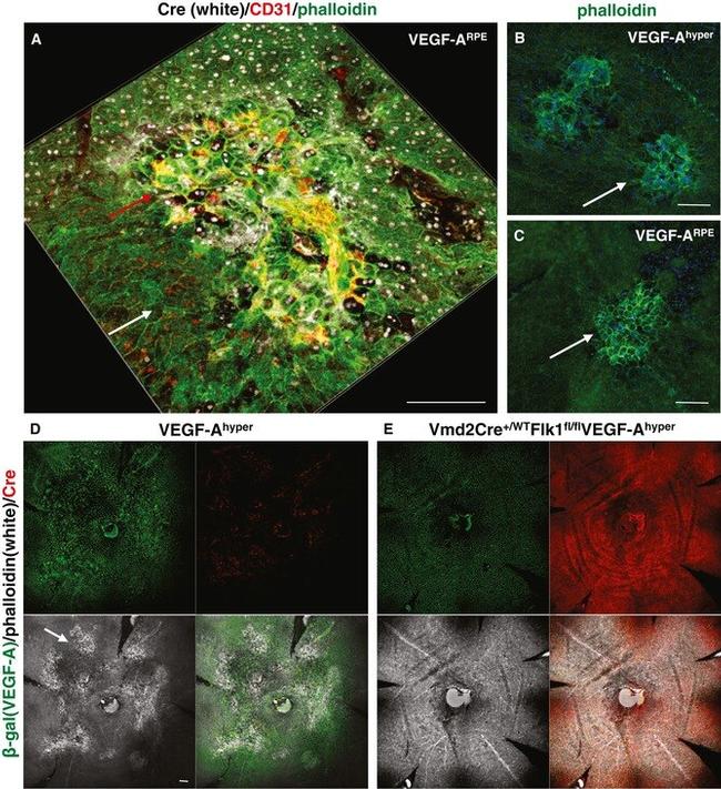 beta Galactosidase Antibody in Immunohistochemistry (IHC)