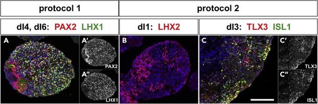 PAX2 Antibody in Immunocytochemistry (ICC/IF)