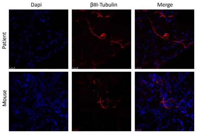 beta-3 Tubulin Antibody in Immunohistochemistry (Paraffin) (IHC (P))