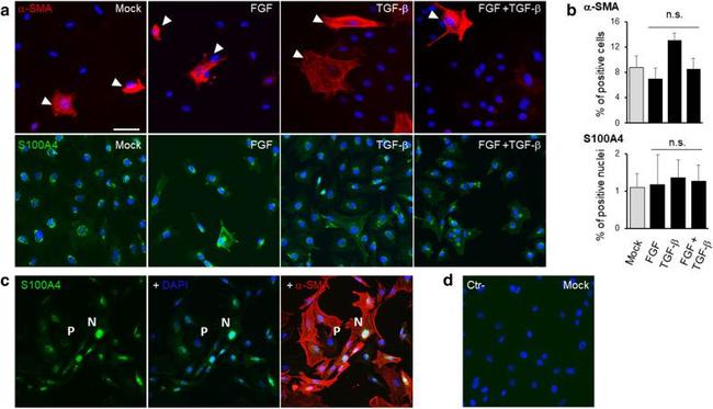 S100A4 Antibody in Immunocytochemistry (ICC/IF)