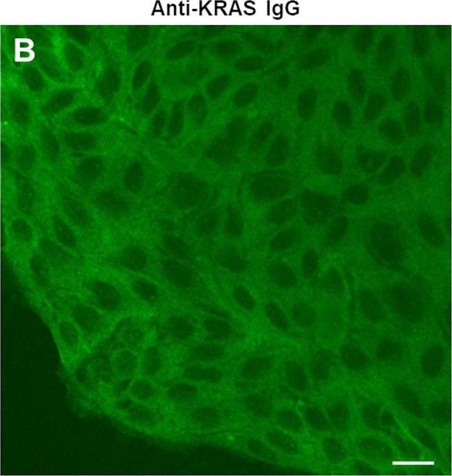 Rabbit IgG (H+L) Cross-Adsorbed Secondary Antibody in Immunocytochemistry (ICC/IF)