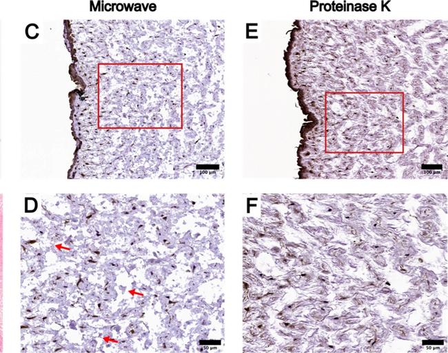 Mouse IgG (H+L) Secondary Antibody in Immunohistochemistry (IHC)