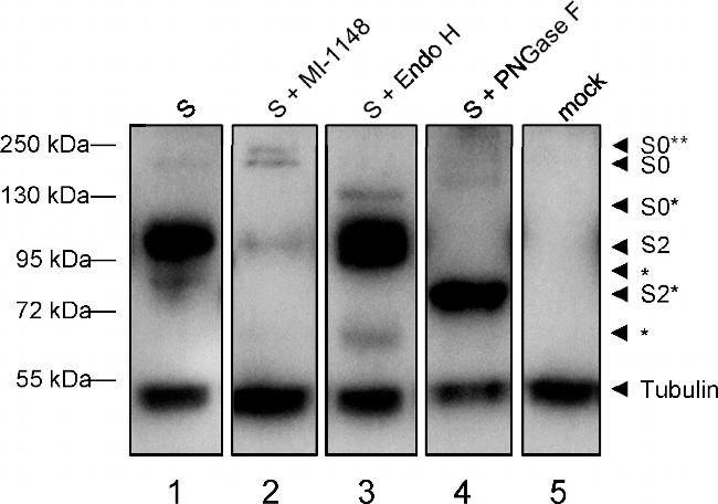 Human IgG (H+L) Secondary Antibody in Western Blot (WB)