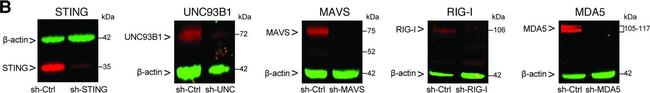 Rabbit IgG (H+L) Secondary Antibody in Western Blot (WB)