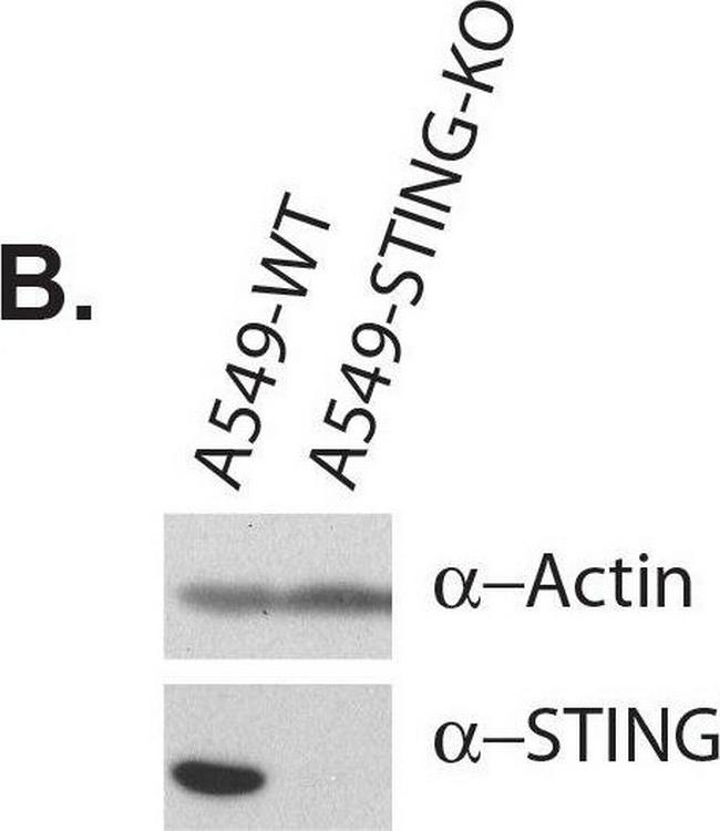 Mouse IgG (H+L) Secondary Antibody in Western Blot (WB)