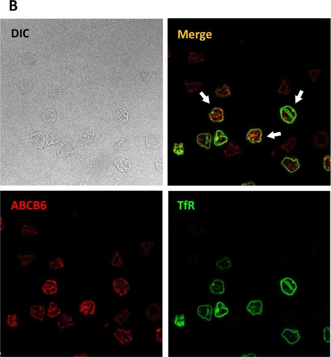 Mouse IgG (H+L) Highly Cross-Adsorbed Secondary Antibody in Immunocytochemistry (ICC/IF)