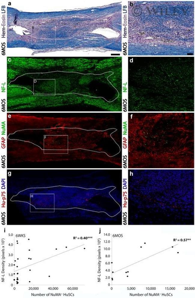 NuMA Antibody in Immunohistochemistry (IHC)