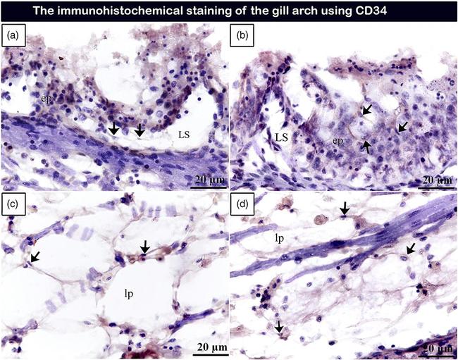 CD34 Antibody in Immunohistochemistry (IHC)