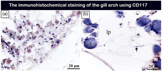 CD117 (c-Kit) Antibody in Immunohistochemistry (IHC)