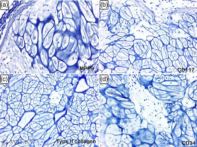 CD117 (c-Kit) Antibody in Immunohistochemistry (IHC)