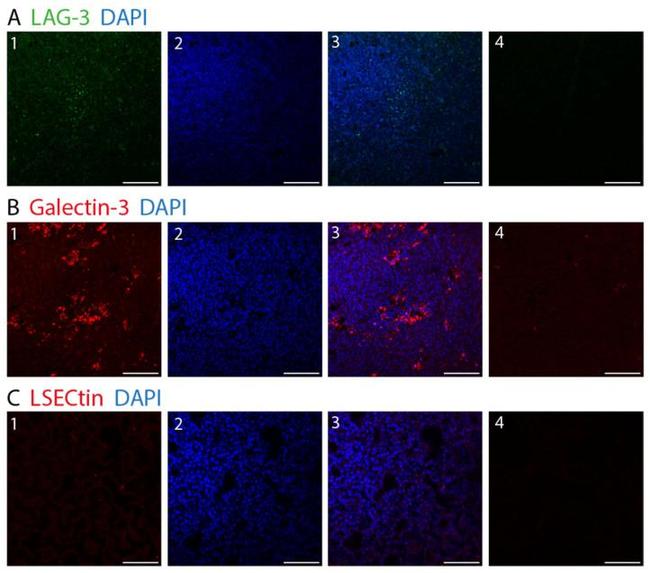 Galectin 3 Antibody in Immunohistochemistry (IHC)