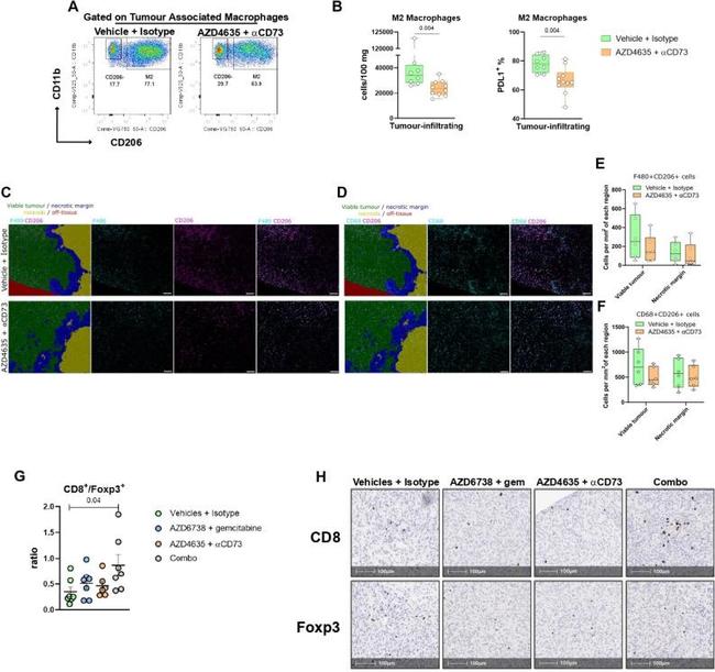 FOXP3 Antibody in Immunohistochemistry (Paraffin) (IHC (P))