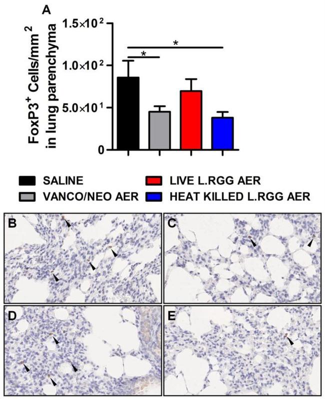 FOXP3 Antibody in Immunohistochemistry (Paraffin) (IHC (P))