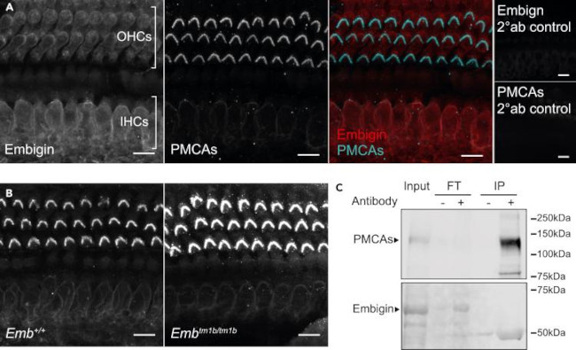 PMCA ATPase Antibody in Immunoprecipitation (IP)