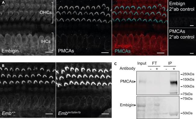 PMCA ATPase Antibody in Immunoprecipitation (IP)