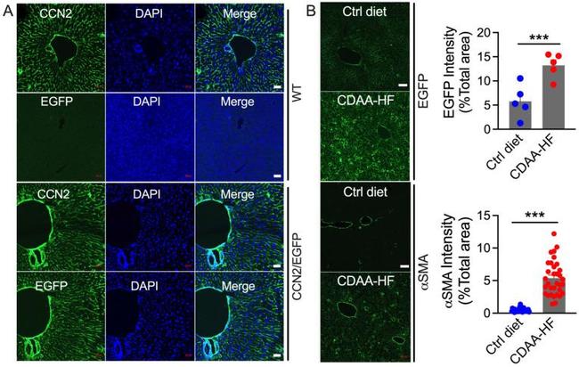 CTGF Antibody in Immunohistochemistry (IHC)