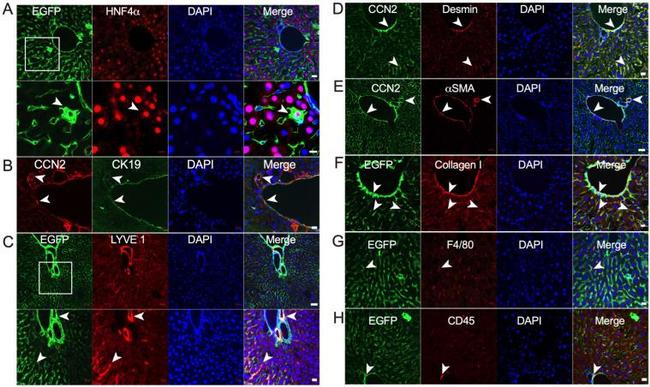 Desmin Antibody in Immunohistochemistry (IHC)