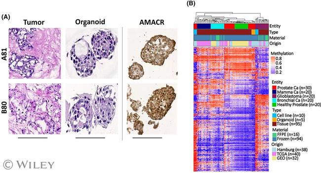 AMACR Antibody in Immunohistochemistry (IHC)