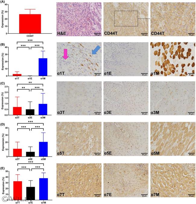 CD44 Antibody in Immunohistochemistry (Paraffin) (IHC (P))