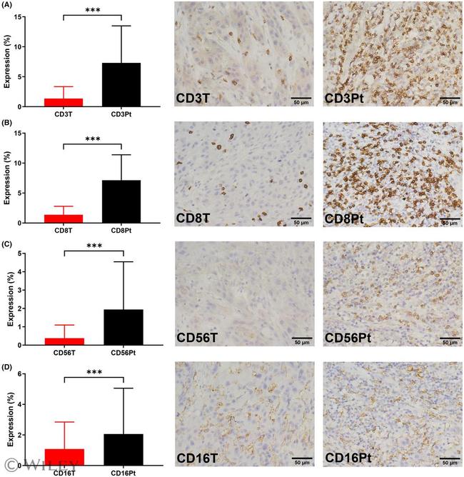 CD56 Antibody in Immunohistochemistry (Paraffin) (IHC (P))