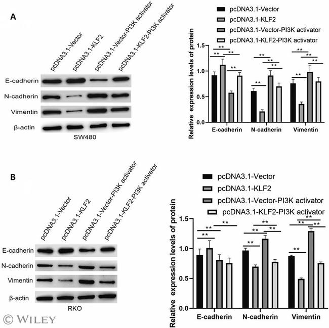 N-cadherin Antibody in Western Blot (WB)