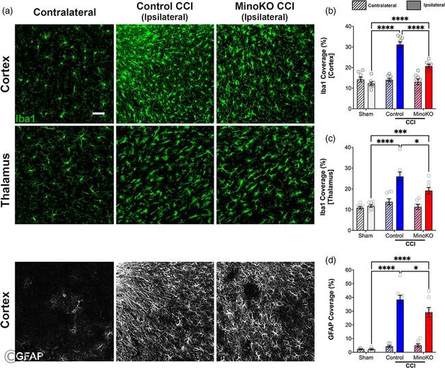 GFAP Antibody in Immunohistochemistry - Free Floating (IHC (Free))