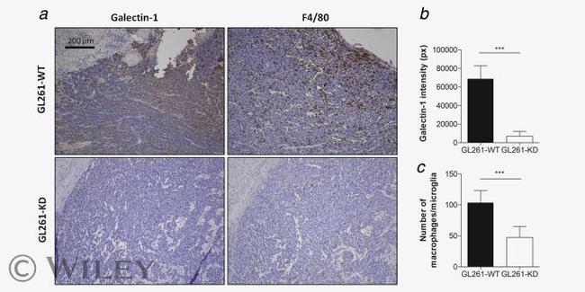 Galectin 1 Antibody in Immunohistochemistry (IHC)