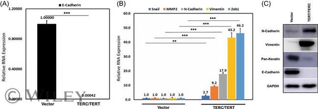 N-cadherin Antibody in Western Blot (WB)