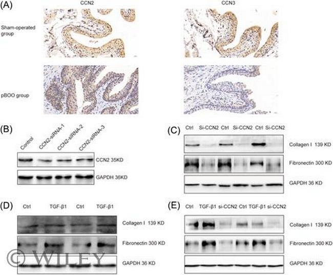 NOV Antibody in Immunohistochemistry (IHC)