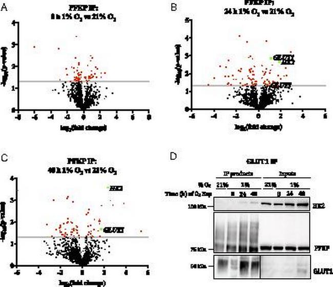 HK2 Antibody in Western Blot (WB)