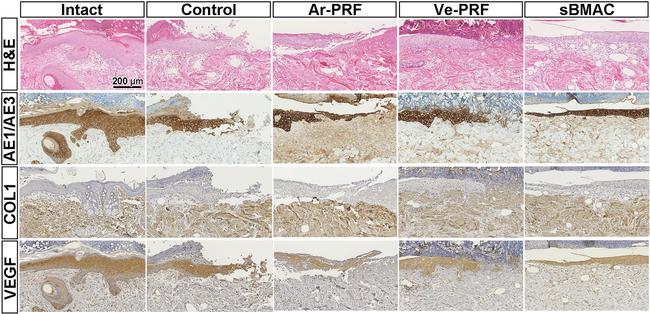 VEGF Antibody in Immunohistochemistry (IHC)