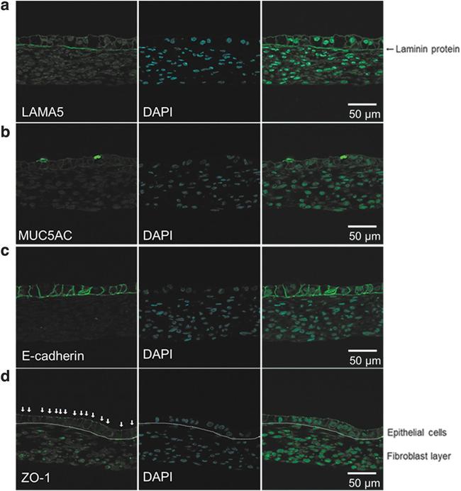 MUC5AC Antibody in Immunohistochemistry (IHC)