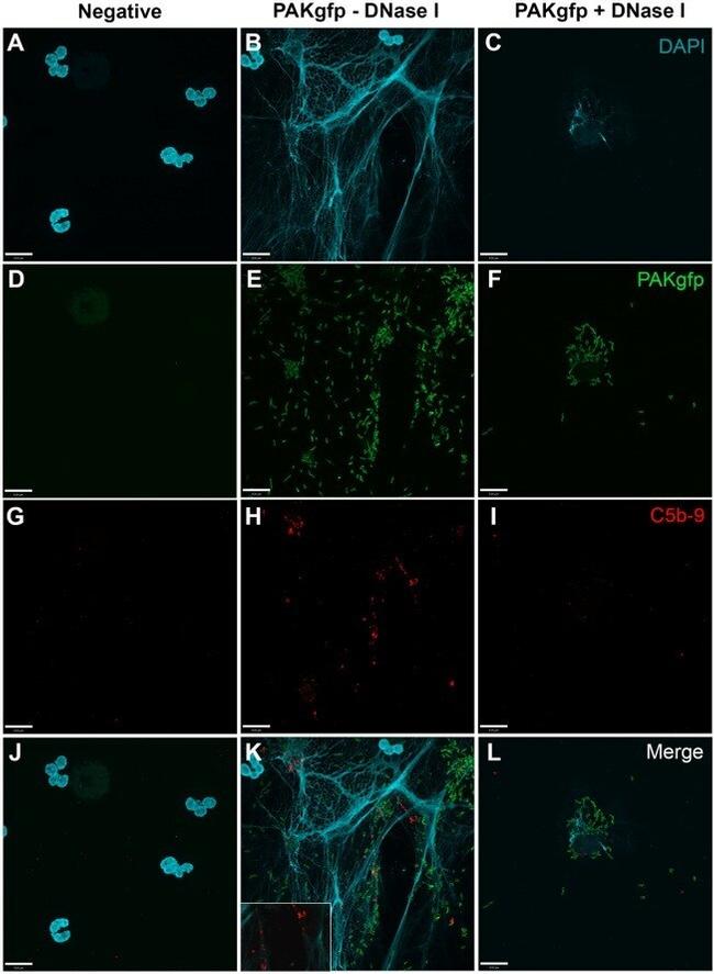 Complement C5b Antibody in Immunocytochemistry (ICC/IF)