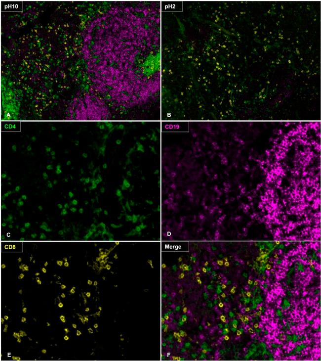 CD4 Antibody in Immunohistochemistry (IHC)