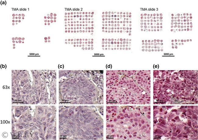 MAGEH1 Antibody in Immunohistochemistry (Paraffin) (IHC (P))